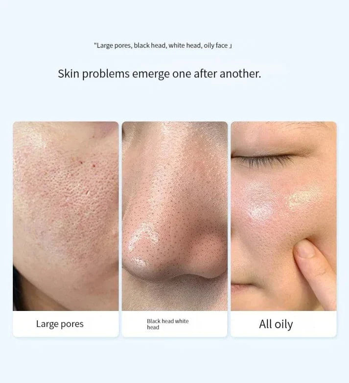 Oligopeptide Small Bubble Cleansing Essence(10 Pcs)