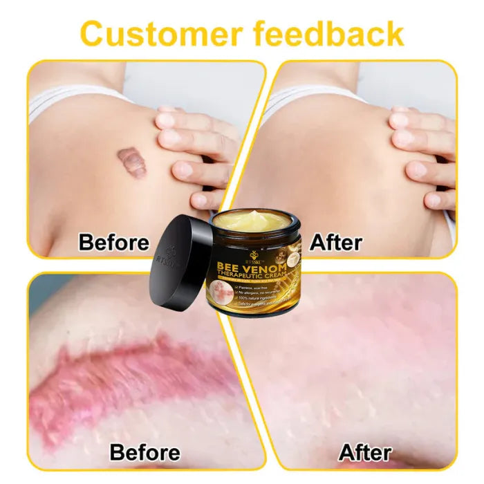 Bee Venom Skin Treatment Cream
