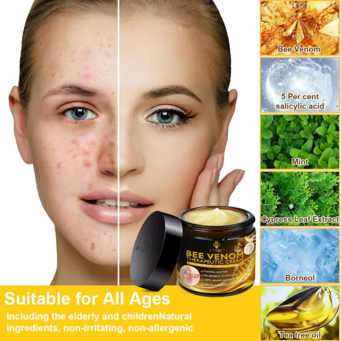 Bee Venom Skin Treatment Cream